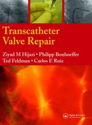 Transcatheter Valve Repair