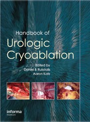 Handbook of Urologic Cryoablation