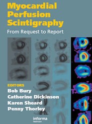Myocardial Perfusion Scintigraphy