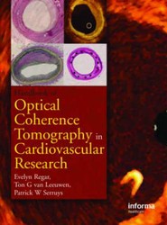 Optical Coherence Tomography in Cardiovascular Research