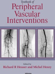 Textbook of Peripheral Vascular Interventions