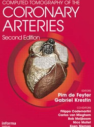 Computed Tomography of the Coronary Arteries