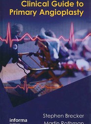 Clinical Guide to Primary Angioplasty