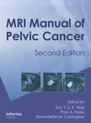 MRI Manual of Pelvic Cancer,Second Edition