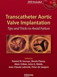 Transcatheter Aortic Valve Implantation