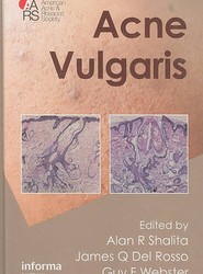 Acne Vulgaris