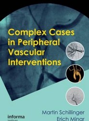Complex Cases in Peripheral Vascular Interventions