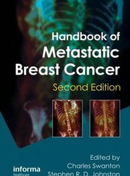 Handbook of Metastatic Breast Cancer