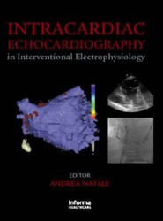 Intracardiac Echocardiography in Interventional Electrophysiology