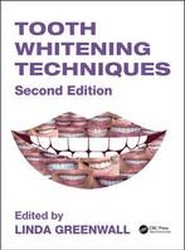 Tooth Whitening Techniques