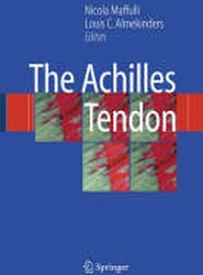 The Achilles Tendon
