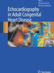 Echocardiography in Adult Congenital Heart Disease