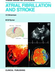 Atrial Fibrillation and Stroke