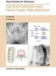 Osteoporosis and Fracture Prevention