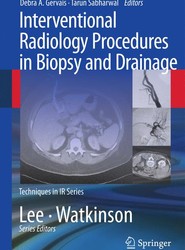 Interventional Radiology Procedures in Biopsy and Drainage