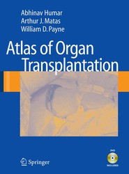 Atlas of Organ Transplantation