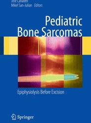 Pediatric Bone Sarcomas