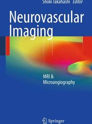 Neurovascular Imaging