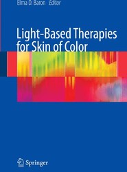 Light-Based Therapies for Skin of Color