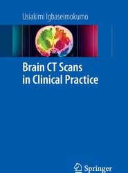 Brain CT Scans in Clinical Practice