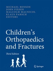 Children's Orthopaedics and Fractures