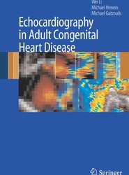 Echocardiography in Adult Congenital Heart Disease