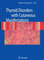 Thyroid Disorders with Cutaneous Manifestations
