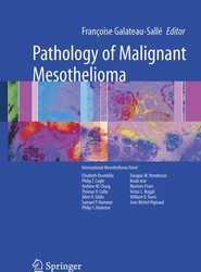 Pathology of Malignant Mesothelioma