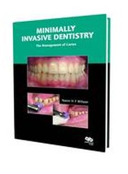 Minimally Invasive Dentistry
