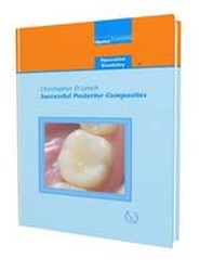 Successful Posterior Composites