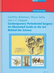 Contemporary Peridontal Surgery