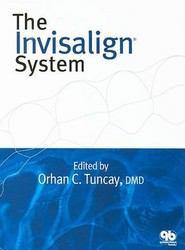 The Invisalign System