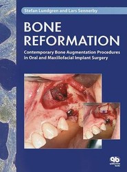 Bone Reformation