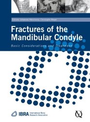 Fractures of the Mandibular Condyle