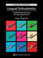 Lingual Orthodontics