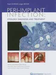 Peri-Implant Infection Etiology