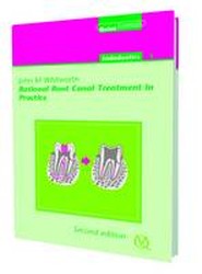 Rational Root Canal Treatment in Practice
