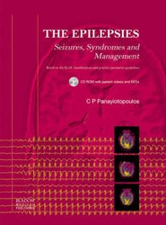 The Epilepsies
