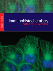 Immunohistochemistry