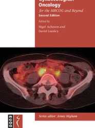 Gynaecological Oncology for the MRCOG and Beyond