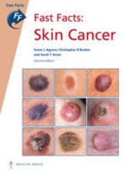 Fast Facts: Skin Cancer