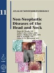 Non-Neoplastic Diseases of the Head and Neck