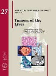 Tumors of the Liver