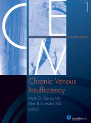 Chronic Venous Insufficiency