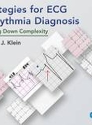 Strategies for ECG Arrhythmia Diagnosis