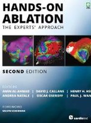 Hands-On Ablation