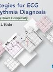 Strategies for ECG Arrhythmia Diagnosis