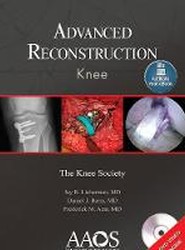 Advanced Reconstruction: Knee: Print + Ebook with Multimedia