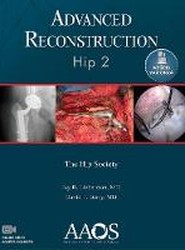 Advanced Reconstruction: Hip 2: Print + Ebook with Multimedia