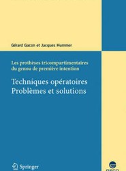 Les Protheses Tricompartimentaires Du Genou De Premiere Intention